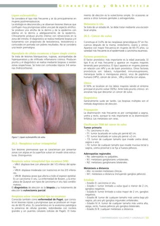 G i n e c o l o g í a
Liquen escleroatrófico
Se considera el tipo más frecuente y se da principalmente en
mujeres postmenopáusicas.
La etiología es desconocida y se observan lesiones blancas que
confluyen muy pruriginosas sobre una piel de aspecto atrófico.
Se produce una atrofia de la dermis y de la epidermis con
edema en la dermis y adelgazamiento de la epidermis.
Clínicamente produce prurito intenso con retracciones en la
zona del introito. El diagnóstico se realiza mediante biopsia y el
tratamiento con propionato de testosterona, testosterona o
corticoides en pomada con pobres resultados. No se considera
una lesión premaligna.

y

O b s t e t r i c i a

miento de elección es la vulvectomía simple. En ocasiones se
asocia a otros tumores genitales o extragenitales.

Melanoma in situ
Se trata de un estadio IA. Se debe tratar mediante una escisión
local amplia.

26.3.- Cáncer de vulva
Constituye el 3-4% de las neoplasias ginecológicas (5º en frecuencia después de la mama, endometrio, ovario y cérvix).
Aparece con mayor frecuencia en mujeres de 65-75 años. La
variedad más frecuente es el epidermoide o carcinoma escamoso.

Hiperplasia de células escamosas o liquen simple crónico
Se trata de lesiones blanquecinas, rugosas, acompañadas de
hiperqueratosis y de infiltrado inflamatorio crónico. Producen
prurito y el diagnóstico se realiza mediante biopsias si existen
zonas sospechosas. Se trata con corticoides tópicos 3-6 semanas (hidrocortisona).

Factores pronósticos
El factor pronóstico más importante es la edad avanzada. El
tipo II es el más frecuente y aparece en mujeres mayores
teniendo peor pronóstico. El tipo I aparece en mujeres jóvenes
en relación con HPV y es de buen pronóstico. Otros factores
pronósticos son: tabaco, nuliparidad, inmunosupresores,
menarquia tardía o menopausia precoz, virus de papiloma
humano (HPV), cáncer de cérvix , VIN y distrofia con atipias.

Clínica
El 50% se localizan en los labios mayores siendo el síntoma
principal el prurito vulvar (50%). Ante todo prurito crónico en
ancianas hay que descartar un cáncer de vulva.

Diagnóstico
Generalmente suele ser tardío. Las biopsias múltiples son el
método diagnóstico de elección.

Propagación
La diseminación más frecuente es por contigüidad a vagina,
uretra y recto, aunque la más importante es la diseminación
linfática. Las metástasis son raras.

Clasificación TNM del cáncer de vulva

Figura 1. Liquen escleroatrófico de vulva.

26.2.- Neoplasia vulvar intaepitelial
Son lesiones preinvasivas que se caracterizan por presentar
zonas con atipias en la superficie vulvar sin invadir otras estructuras. Distinguimos:

Neoplasia vulvar intaepitelial tipo escamoso (VIN)
- VIN I: displasia leve con alteración del 1/3 inferior del epitelio.
- VIN II: displasia moderada con trastornos en los 2/3 inferiores.
- VIN III: displasia grave que afecta a todo el espesor epitelial.
Es un carcinoma in situ. La enfermedad de Bowen, y la eritoplasia de Queyrat son tipos de carcinoma in situ tipo condilomatoso.
El diagnóstico de elección es la biopsia y su tratamiento de
elección la vulvectomía parcial.

Neoplasia vulvar intaepitelial tipo no escamoso
Conocida también como enfermedad de Paget, que consiste en lesiones rojizas y pruriginosas que se producen en mujeres de 60-70 años. Es característico en la anatomía patológica
la presencia de células grandes, redondeadas con núcleos
grandes y sin puentes celulares (células de Paget). El trata-

Tumor primario
- Tis: carcinoma in situ.
- T1: tumor localizado en vulva y/o periné ≤2 cm.
- T2: tumor localizado en vulva y/o periné >2 cm.
- T3: tumor de cualquier tamaño que invade uretra distal,
vagina o ano.
- T4: tumor de cualquier tamaño que invade mucosa rectal o
vagina, uretra proximal o se fija a huesos pélvicos.
Adenopatías regionales
- No: adenopatías no palpables.
- N1: metástasis ganglionares unilaterales.
- N2: metástasis ganglionares bilaterales.
Metástasis a distancia
- Mo: no existen metástasis clínicas.
- M1: metástasis a distancia (incluyendo ganglios pélvicos).

Estadiaje
- Estadio 0: carcinoma in situ.
- Estadio I: tumor limitado a vulva igual o menor de 2 cm,
ganglios negativos.
- Estadio II: tumor limitado a vulva mayor de 2 cm, ganglios
negativos.
- Estadio III: tumor de cualquier tamaño más uretra baja y/o
vagina, y/o ano y/o ganglios inguinales unilaterales.
- Estadio IV A: tumor de cualquier tamaño más uretra alta,
vejiga, recto, huesos pélvicos y/o ganglios bilaterales.
- Estadio IV B: cualquier metástasis a distancia.

] ENFERMEDADES VULVARES Y VAGINALES [ 59

 