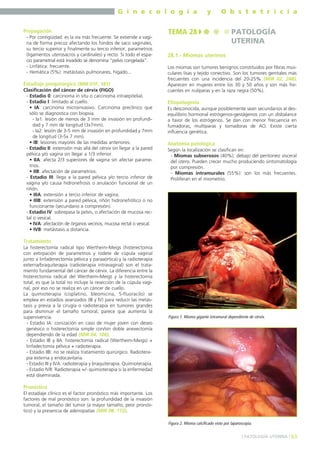 G i n e c o l o g í a
Propagación
- Por contigüidad: es la vía más frecuente. Se extiende a vagina de forma precoz afectando los fondos de saco vaginales,
su tercio superior y finalmente su tercio inferior, parametrios
(ligamentos uterosacros y cardinales) y recto. Si todo el espacio parametrial está invadido se denomina "pelvis congelada".
- Linfática: frecuente.
- Hemática (5%): metástasis pulmonares, hígado...

Estadiaje prequirúrgico (MIR 01F, 181)
Clasificación del cáncer de cérvix (FIGO)
- Estadio 0: carcinoma in situ o carcinoma intraepitelial.
- Estadio I: limitado al cuello.
• IA: carcinoma microinvasivo. Carcinoma preclínico que
sólo se diagnostica con biopsia.
- Ia1: lesión de menos de 3 mm de invasión en profundidad y 7 mm de longitud (3x7mm).
- Ia2: lesión de 3-5 mm de invasión en profundidad y 7mm
de longitud (3-5x 7 mm).
• IB: lesiones mayores de las medidas anteriores.
- Estadio II: extensión más allá del cérvix sin llegar a la pared
pélvica y/o vagina sin llegar a 1/3 inferior.
• IIA: afecta 2/3 superiores de vagina sin afectar parametrios.
• IIB: afectación de parametrios.
- Estadio III: llega a la pared pélvica y/o tercio inferior de
vagina y/o causa hidronefrosis o anulación funcional de un
riñón.
• IIIA: extensión a tercio inferior de vagina.
• IIIB: extensión a pared pélvica, riñón hidronefrótico o no
funcionante (secundario a compresión).
- Estadio IV: sobrepasa la pelvis, o afectación de mucosa rectal o vesical.
• IVA: afectación de órganos vecinos, mucosa rectal o vesical.
• IVB: metástasis a distancia.

y

O b s t e t r i c i a

TEMA 28

PATOLOGÍA
UTERINA

28.1.- Miomas uterinos
Los miomas son tumores benignos constituidos por fibras musculares lisas y tejido conectivo. Son los tumores genitales más
frecuentes con una incidencia del 20-25% (MIR 02, 248).
Aparecen en mujeres entre los 30 y 50 años y son más frecuentes en nulíparas y en la raza negra (50%).

Etiopatogenia
Es desconocida, aunque posiblemente sean secundarios al desequilibrio hormonal estrógenos-gestágenos con un disbalance
a favor de los estrógenos. Se dan con menor frecuencia en
fumadoras, multíparas y tomadoras de AO. Existe cierta
influencia genética.

Anatomía patológica
Según la localización se clasifican en:
- Miomas subserosos (40%): debajo del peritoneo visceral
del útero. Pueden crecer mucho produciendo sintomatología
por compresión.
- Miomas intramurales (55%): son los más frecuentes.
Proliferan en el miometrio.

Tratamiento
La histerectomía radical tipo Wertheim-Meigs (histerectomía
con extirpación de parametrios y rodete de cúpula vaginal
junto a linfadenectomía pélvica y paraaórtica) y la radioterapia
externa/braquiterapia (radioterapia intravaginal) son el tratamiento fundamental del cáncer de cérvix. La diferencia entre la
histerectomía radical del Wertheim-Meigs y la histerectomía
total, es que la total no incluye la resección de la cúpula vaginal, por eso no se realiza en un cáncer de cuello.
La quimioterapia (cisplatino, bleomicina, 5-fluoracilo) se
emplea en estadios avanzados (III y IV) para reducir las metástasis y previa a la cirugía o radioterapia en tumores grandes
para disminuir el tamaño tumoral; parece que aumenta la
supervivencia.
- Estadio IA: conización en caso de mujer joven con deseo
genésico o histerectomía simple con/sin doble anexectomía
dependiendo de la edad (MIR 04, 106).
- Estadio IB y IIA: histerectomía radical (Wertheim-Meigs) +
linfadectomía pélvica + radioterapia.
- Estadio IIB: no se realiza tratamiento quirúrgico. Radioterapia externa y endocavitaria.
- Estadio III y IVA: radioterapia y braquiterapia. Quimioterapia.
- Estadio IVB: Radioterapia +/- quimioterapia si la enfermedad
está diseminada.

Figura 1. Mioma gigante intramural dependiente de cérvix.

Pronóstico
El estadiaje clínico es el factor pronóstico más importante. Los
factores de mal pronóstico son: la profundidad de la invasión
tumoral, el tamaño del tumor (a mayor tamaño, peor pronóstico) y la presencia de adenopatías (MIR 08, 172).
Figura 2. Mioma calcificado visto por laparoscopia.
] PATOLOGÍA UTERINA [ 63

 