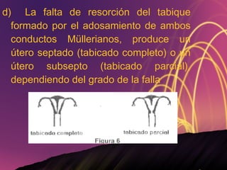 d) La falta de resorción del tabique formado por el adosamiento de ambos conductos Müllerianos, produce un útero septado (tabicado completo) o un útero subsepto (tabicado parcial), dependiendo del grado de la falla  
