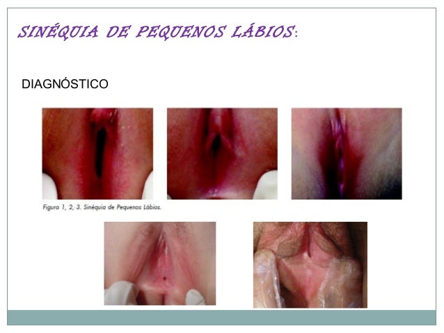 Em total sobre pênis como aumentar