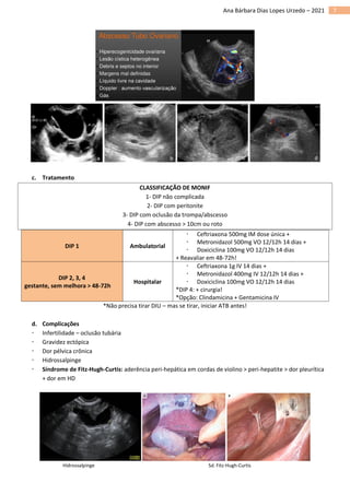 7
Ana Bárbara Dias Lopes Urzedo – 2021
c. Tratamento
CLASSIFICAÇÃO DE MONIF
1- DIP não complicada
2- DIP com peritonite
3- DIP com oclusão da trompa/abscesso
4- DIP com abscesso > 10cm ou roto
DIP 1 Ambulatorial
 Ceftriaxona 500mg IM dose única +
 Metronidazol 500mg VO 12/12h 14 dias +
 Doxiciclina 100mg VO 12/12h 14 dias
+ Reavaliar em 48-72h!
DIP 2, 3, 4
gestante, sem melhora > 48-72h
Hospitalar
 Ceftriaxona 1g IV 14 dias +
 Metronidazol 400mg IV 12/12h 14 dias +
 Doxiciclina 100mg VO 12/12h 14 dias
*DIP 4: + cirurgia!
*Opção: Clindamicina + Gentamicina IV
*Não precisa tirar DIU – mas se tirar, iniciar ATB antes!
d. Complicações
 Infertilidade – oclusão tubária
 Gravidez ectópica
 Dor pélvica crônica
 Hidrossalpinge
 Síndrome de Fitz-Hugh-Curtis: aderência peri-hepática em cordas de violino > peri-hepatite > dor pleurítica
+ dor em HD
Hidrossalpinge Sd. Fitz-Hugh-Curtis
 