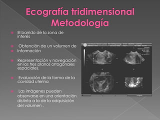  El barrido de la zona de
interés
 Obtención de un volumen de
 Información
 Representación y navegación
en los tres planos ortogonales
espaciales.
 Evaluación de la forma de la
cavidad uterina
 Las imágenes pueden
observarse en una orientación
distinta a la de la adquisición
del volumen .
 