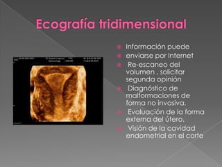  Información puede
 enviarse por Internet
 Re-escaneo del
volumen , solicitar
segunda opinión
 Diagnóstico de
malformaciones de
forma no invasiva.
 Evaluación de la forma
externa del útero.
 Visión de la cavidad
endometrial en el corte
 