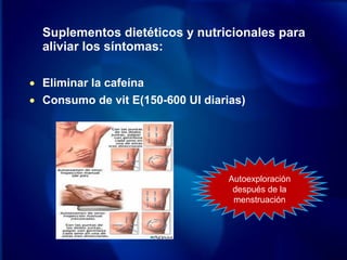 Suplementos dietéticos y nutricionales para
aliviar los síntomas:
• Eliminar la cafeína
• Consumo de vit E(150-600 UI diarias)
Autoexploración
después de la
menstruación
 