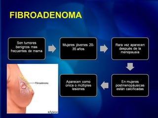 FIBROADENOMA
 