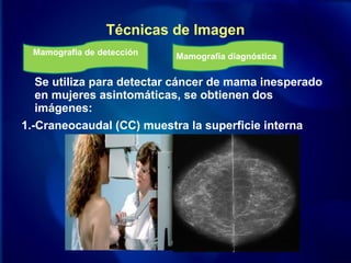 Se utiliza para detectar cáncer de mama inesperado
en mujeres asintomáticas, se obtienen dos
imágenes:
1.-Craneocaudal (CC) muestra la superficie interna
Técnicas de Imagen
Mamografía de detección Mamografía diagnóstica
 