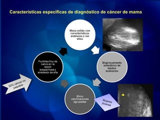 Características especificas de diagnóstico de cáncer de mama
50% cáncer no
palpable50% cáncer no
palpable
Mujeresjóvenes
Mujeresjóvenes
 