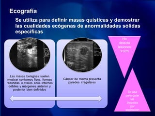 Ecografía
Se utiliza para definir masas quísticas y demostrar
las cualidades ecógenas de anormalidades sólidas
específicas
No
detecta
lesiones
≤1cm
Se usa
para guiar
las
biopsias
por
aspiración
 