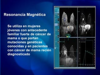 Resonancia Magnética
Se utiliza en mujeres
jóvenes con antecedente
familiar fuerte de cáncer de
mama o que portan
mutaciones genéticas
conocidas y en pacientes
con cáncer de mama recién
diagnosticado
 