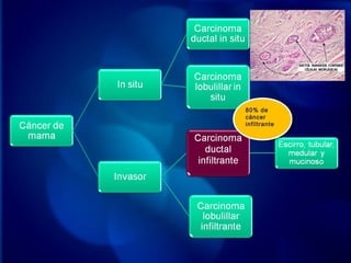80% de
cáncer
infiltrante
80% de
cáncer
infiltrante
 