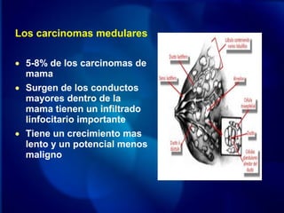 Los carcinomas medulares
• 5-8% de los carcinomas de
mama
• Surgen de los conductos
mayores dentro de la
mama tienen un infiltrado
linfocitario importante
• Tiene un crecimiento mas
lento y un potencial menos
maligno
 