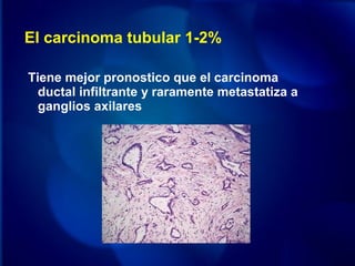 El carcinoma tubular 1-2%
Tiene mejor pronostico que el carcinoma
ductal infiltrante y raramente metastatiza a
ganglios axilares
 