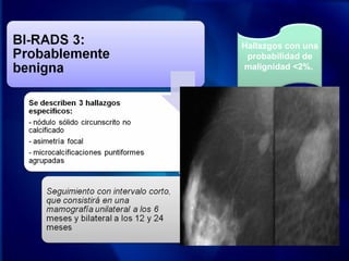 Hallazgos con una
probabilidad de
malignidad <2%.
 