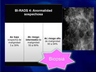 Biopsia
 