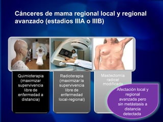 Cánceres de mama regional local y regional
avanzado (estadios IIIA o IIIB)
Afectación local y
regional
avanzada pero
sin metástasis a
distancia
detectada
 