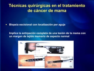 Técnicas quirúrgicas en el tratamiento
de cáncer de mama
• Biopsia escisional con localización por aguja
Implica la extirpación completa de una lesión de la mama con
un margen de tejido mamario de aspecto normal
 