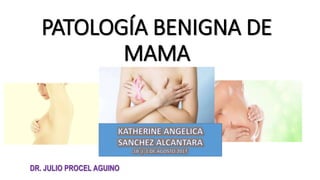 PATOLOGÍA BENIGNA DE
MAMA
DR. JULIO PROCEL AGUINO
 