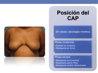 Posición del
     CAP

 Sin ptosis: abordajes mínimos



Ptosis moderada
• Excisión en croissant
• Mastopexia en donut



Ptosis severa
• Mastopexia circunvertical
• Mastopexia patrón Wise
• Mastopexia cicatriz inframamaria
 