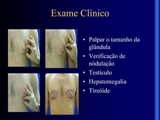 Exame Clínico
• Palpar o tamanho da
glândula
• Verificação de
nódulação
• Testículo
• Hepatomegalia
• Tireóide
 