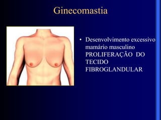 Ginecomastia
• Desenvolvimento excessivo
mamário masculino
PROLIFERAÇÃO DO
TECIDO
FIBROGLANDULAR
 