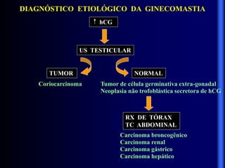 DIAGNÓSTICO ETIOLÓGICO DA GINECOMASTIA
hCG
US TESTICULAR
TUMOR NORMAL
Coriocarcinoma Tumor de célula germinativa extra-gonadal
Neoplasia não trofoblástica secretora de hCG
RX DE TÓRAX
TC ABDOMINAL
Carcinoma broncogênico
Carcinoma renal
Carcinoma gástrico
Carcinoma hepático
 