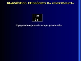DIAGNÓSTICO ETIOLÓGICO DA GINECOMASTIA
LH
T
Hipogonadismo primário ou hipergonadotrófico
 