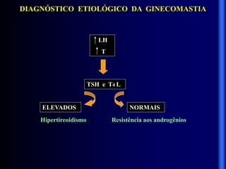 DIAGNÓSTICO ETIOLÓGICO DA GINECOMASTIA
LH
T
TSH e T4 L
ELEVADOS NORMAIS
Hipertireoidismo Resistência aos androgênios
 