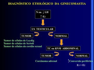 DIAGNÓSTICO ETIOLÓGICO DA GINECOMASTIA
N ou LH
E2
US TESTICULAR
TUMOR NORMAL
Tumor de células de Leydig
Tumor de células de Sertoli
Tumor de células do cordão sexual
TC ou RNM ABDOMINAL
TUMOR NORMAL
Carcinoma adrenal Conversão periférica
E1 > E2
 
