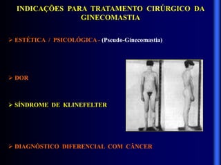 INDICAÇÕES PARA TRATAMENTO CIRÚRGICO DA
GINECOMASTIA
 ESTÉTICA / PSICOLÓGICA - (Pseudo-Ginecomastia)
 DOR
 SÍNDROME DE KLINEFELTER
 DIAGNÓSTICO DIFERENCIAL COM CÂNCER
 