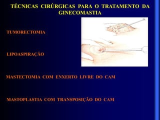 TÉCNICAS CIRÚRGICAS PARA O TRATAMENTO DA
GINECOMASTIA
TUMORECTOMIA
LIPOASPIRAÇÃO
MASTECTOMIA COM ENXERTO LIVRE DO CAM
MASTOPLASTIA COM TRANSPOSIÇÃO DO CAM
 