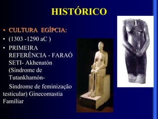 HISTÓRICO
• CULTURA EGÍPCIA:
• (1303 -1290 aC )
• PRIMEIRA
REFERÊNCIA - FARAÓ
SETI- Akhenatón
(Síndrome de
Tutankhamón-
Síndrome de feminização
testicular) Ginecomastia
Familiar
 