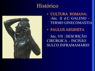Histórico
• CULTURA ROMANA:
-Séc. II d C: GALENO -
TERMO GINECOMASTIA
• PAULUS AEGINETA
Séc. VII : DESCRIÇÃO
CIRÚRGICA - INCISÃO
SULCO INFRAMAMÁRIO
 