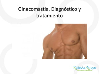 Ginecomastia. Diagnóstico y
tratamiento
 