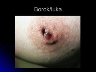 Borok/lukaBorok/luka
 