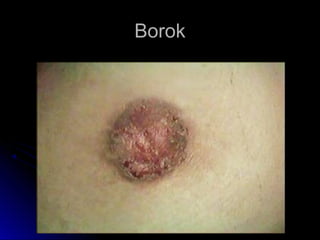 BorokBorok
 