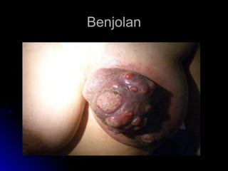 BenjolanBenjolan
 