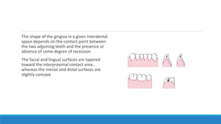 The shape of the gingiva in a given interdental
space depends on the contact point between
the two adjoining teeth and the presence or
absence of some degree of recession
The facial and lingual surfaces are tapered
toward the interproximal contact area ,
whereas the mesial and distal surfaces are
slightly concave
 