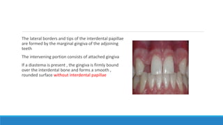 The lateral borders and tips of the interdental papillae
are formed by the marginal gingiva of the adjoining
teeth
The intervening portion consists of attached gingiva
If a diastema is present , the gingiva is firmly bound
over the interdental bone and forms a smooth ,
rounded surface without interdental papillae
 
