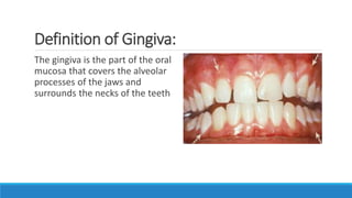 Definition of Gingiva:
The gingiva is the part of the oral
mucosa that covers the alveolar
processes of the jaws and
surrounds the necks of the teeth
 