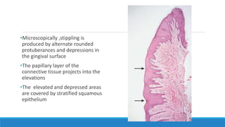 •Microscopically ,stippling is
produced by alternate rounded
protuberances and depressions in
the gingival surface
•The papillary layer of the
connective tissue projects into the
elevations
•The elevated and depressed areas
are covered by stratified squamous
epithelium
 