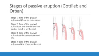 Stages of passive eruption (Gottlieb and
Orban)
Stage 1: Base of the gingival
sulcus and JE are on the enamel
Stage 2: Base of the gingival
sulcus is on the enamel and the
part of the JE is on the root
Stage 3: Base of the gingival
sulcus is at the cementoenamel
line
Stage 4: Base of the gingival
sulcus and the JE are on the root
 