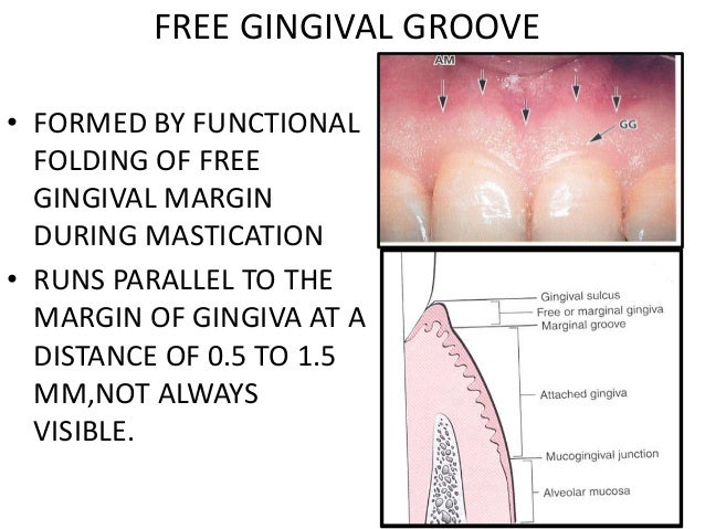 Gingiva