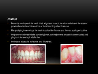 CONTOUR
• Depends on shape of the tooth ,their alignment in arch, location and size of the area of
proximal contact and dimensions of facial and lingual embrasures.
• Marginal gingiva envelops the teeth in collar like fashion and forms a scalloped outline.
• On pronounced mesiodistal convexity( max. canine) normal arcuate is accentuated and
gingiva is located apically farther.
• On lingual aspect its horizontal and thickened.
 