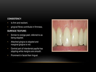 CONSISTENCY:
• Is firm and resilient.
• gingival fibres contribute in firmness.
SURFACE TEXTURE:
• Similar to orange peel, referred to as
being stippled.
• Attached gingiva is stippled and
marginal gingiva is not.
• Central part of interdental papilla has
stippling while margins are smooth.
• Prominent in facial than lingual.
 
