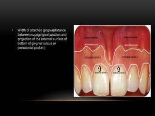 • Width of attached gingiva(distance
between mucogingival junction and
projection of the external surface of
bottom of gingival sulcus or
periodontal pocket )
 