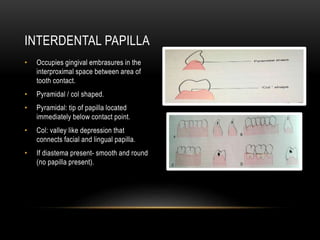 • Occupies gingival embrasures in the
interproximal space between area of
tooth contact.
• Pyramidal / col shaped.
• Pyramidal: tip of papilla located
immediately below contact point.
• Col: valley like depression that
connects facial and lingual papilla.
• If diastema present- smooth and round
(no papilla present).
INTERDENTAL PAPILLA
 