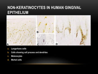 NON-KERATINOCYTES IN HUMAN GINGIVAL
EPITHELIUM
a. Langerhans cells
b. Cells showing cell process and dendrites
c. Melanocytes
d. Merkel cells
 