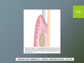 119
NEWMAN AND CARRANZA’S, CLINICAL PERIODONTOLOGY, 13TH ED
 