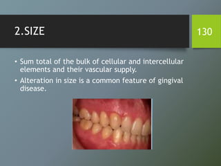 2.SIZE
• Sum total of the bulk of cellular and intercellular
elements and their vascular supply.
• Alteration in size is a common feature of gingival
disease.
130
 