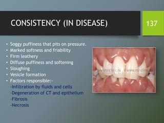 CONSISTENCY (IN DISEASE)
• Soggy puffiness that pits on pressure.
• Marked softness and friability
• Firm leathery
• Diffuse puffiness and softening
• Sloughing
• Vesicle formation
• Factors responsible:-
-Infiltration by fluids and cells
-Degeneration of CT and epithelium
-Fibrosis
-Necrosis
137
 